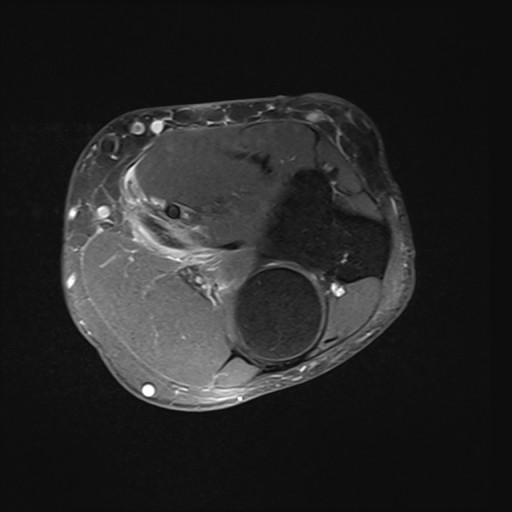 Click on the Serie image to view the images of Wieszt, Gnter